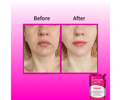 Homeo Cure Beauty Cream Highly Concentrated Fastest 2 Days Results Guaranteed
